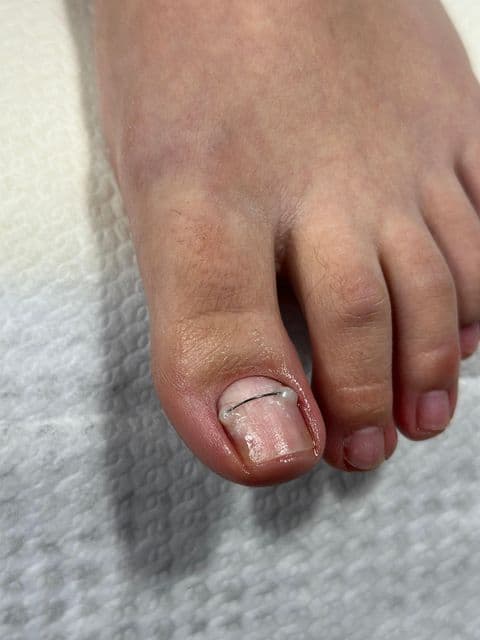 Pedichiură
